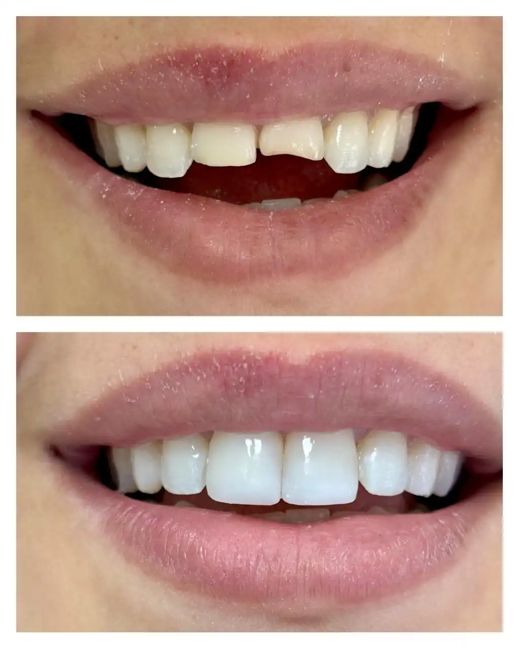 Dentisterie esthétique Tétouan — Cabinet Dr. Ahamout